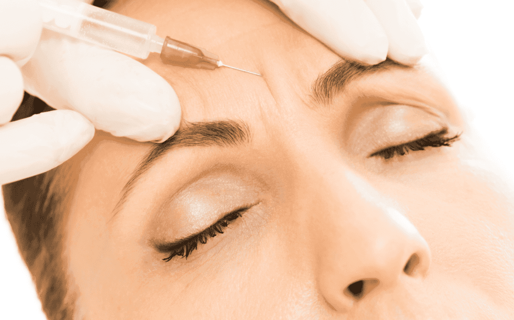 Close-up of a patient receiving Botox injections on the forehead to remove fine lines and wrinkles at a clinic. The procedure involves Botulinum Toxin, a popular treatment in dermatology and aesthetics for wrinkle reduction. Botox cosmetic treatments are commonly used to smooth forehead wrinkles, improve skin appearance, and provide a non-surgical facelift effect. The procedure, often performed in clinics, helps in relaxing facial muscles to reduce the appearance of fine lines around the eyebrows and eyes.