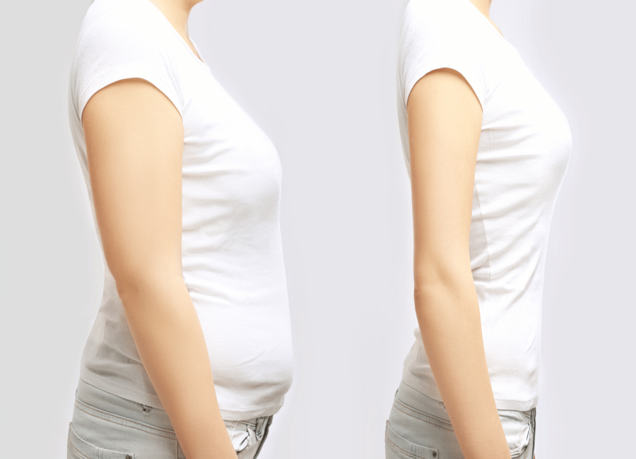 semaglutide result before and after