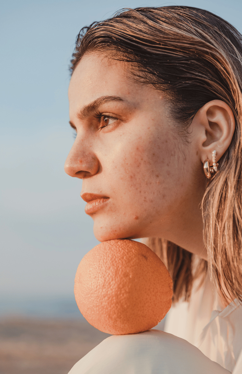 Fades hyperpigmentation and improves skin tone